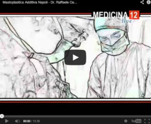 Mastoplastica Additiva – Dr. Raffaele Ceccarino