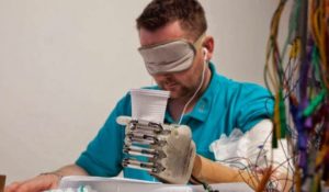 LA MANO BIONICA NON È PIÙ FANTASCIENZA